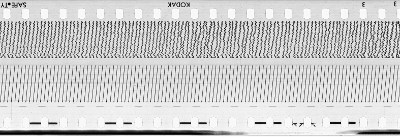 FR751142302_ARECIBO_0012_1970_0096 PNG